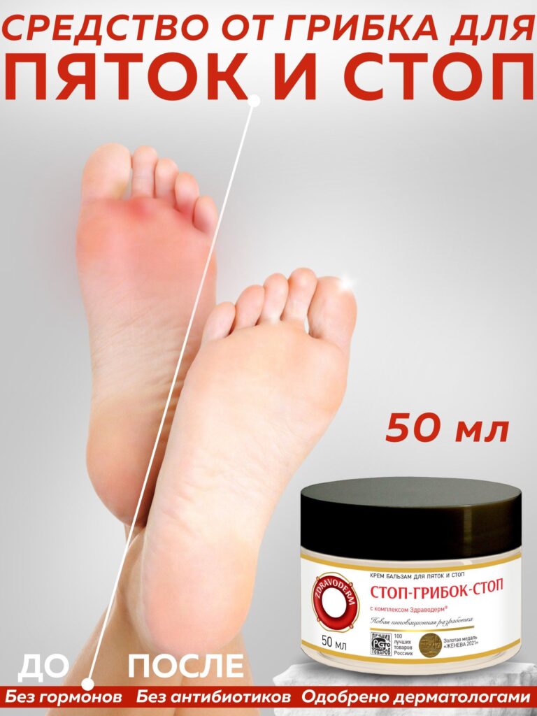 Ot griebka nogteй na nogaхdrawoderm stotop-griobok-stop krem ​​...