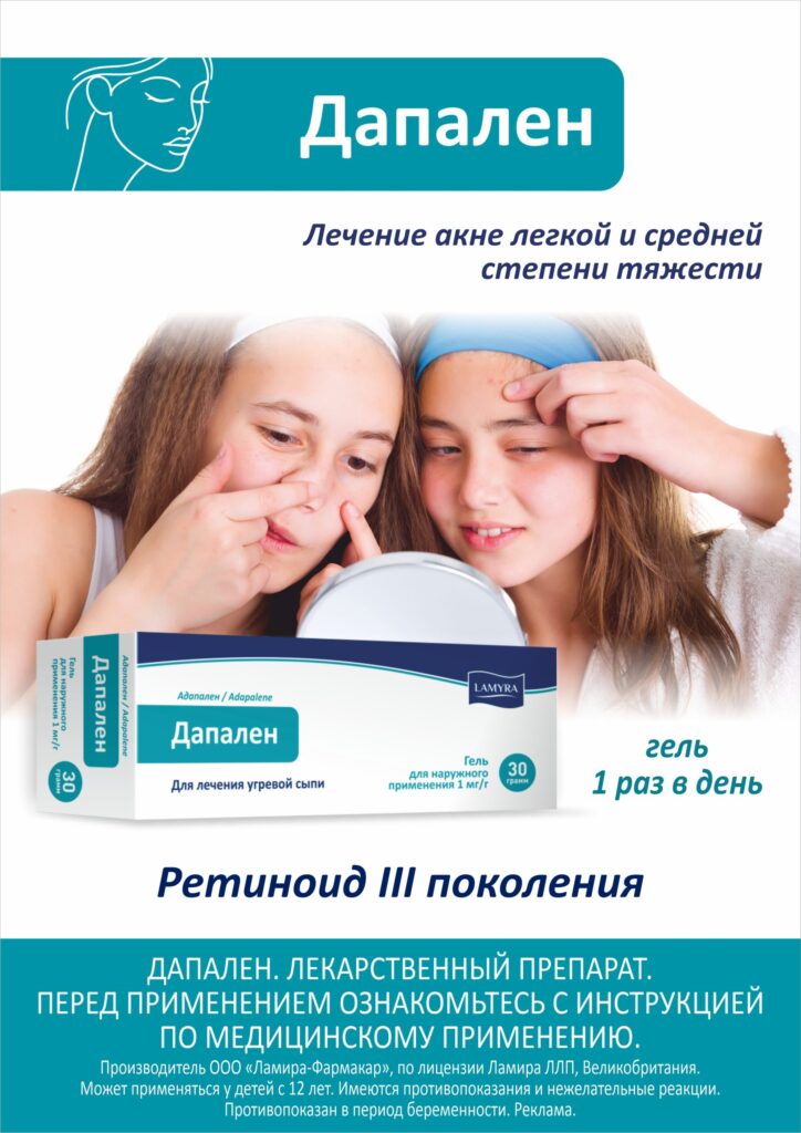 Акне: ибалэр.