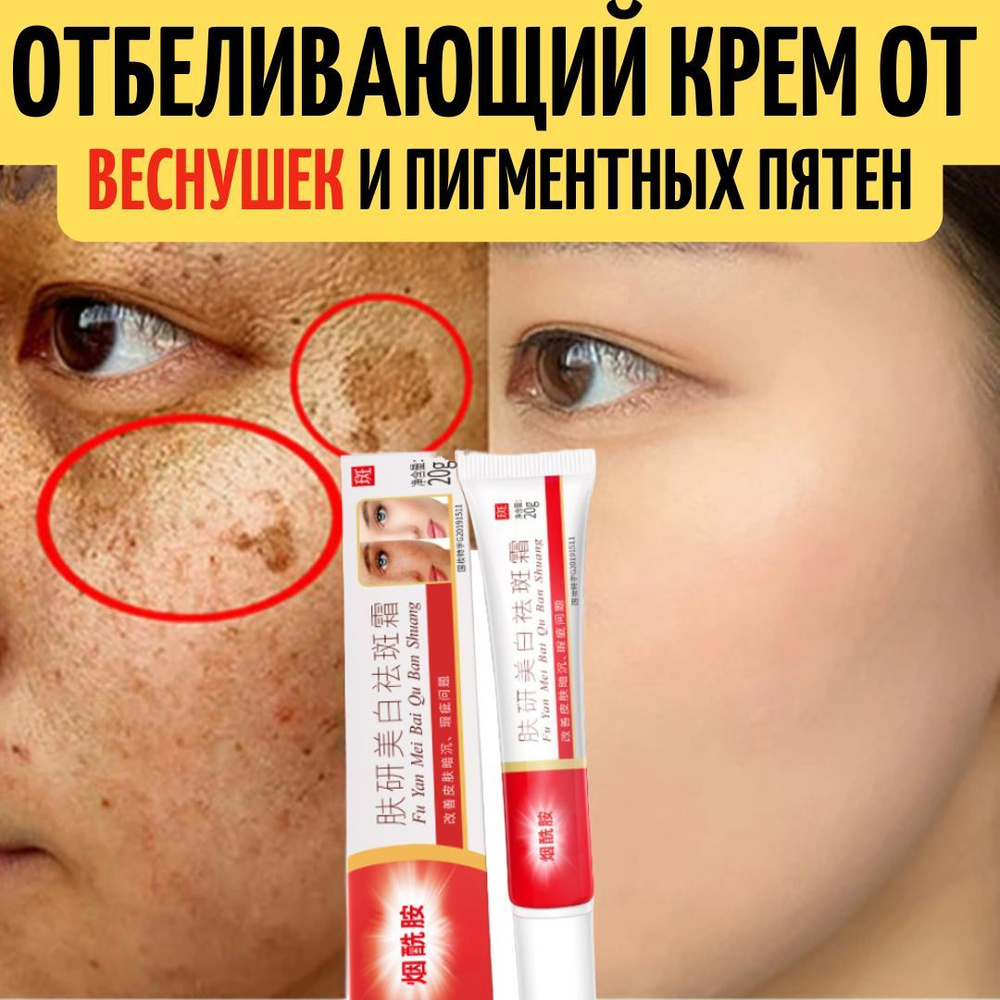Otbelivaющiй kremem otpigentnыхpaetnen onaliцe