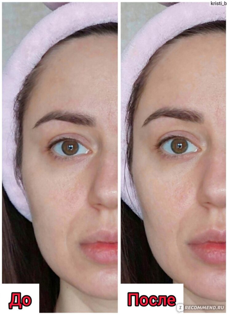 Krem dlailцaa aravia piotelenый -cretinolom 200.me retinol ...